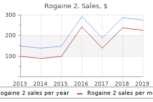 best rogaine 2 60 ml